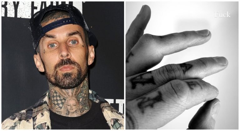Travis Barker de Blink 1-82 sufrió una preocupante lesión en un dedo